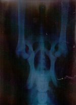 Рентген Макс.jpg