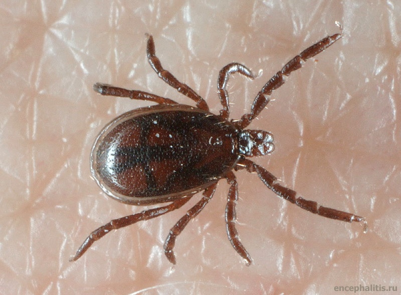 1428163000_ixodes_male.jpg